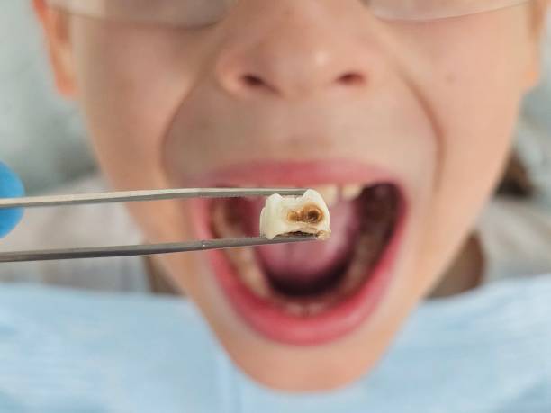 Best Urgent Dental Care for Toothache in Haltom City, TX