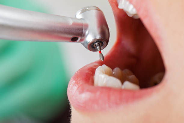 Best Emergency Dental Services for Seniors in Haltom City, TX